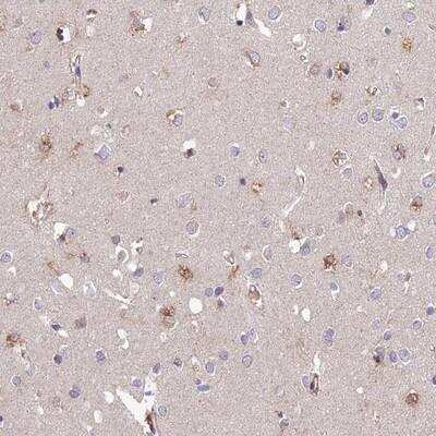 Immunohistochemistry: ARL8A Antibody [NBP2-14315] - Staining of human cerebral cortex shows moderate positivity in a subset of glial cells