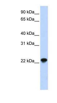 Western Blot: ARL8A Antibody [NBP1-58860] - Titration: 0.2-1 ug/ml, Positive Control: Human Muscle.