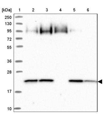Western Blot ARL8A Antibody - BSA Free