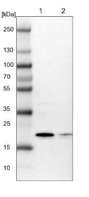 Western Blot ARL8A Antibody - BSA Free