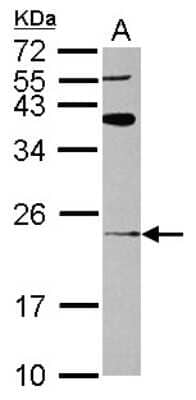 Western Blot: ARL8A Antibody [NBP2-15466] - Sample (30 ug of whole cell lysate) A: U87-MG 12% SDS PAGE gel, diluted at 1:1000.