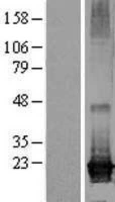 Western Blot ARL8A Overexpression Lysate