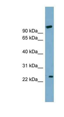 Western Blot: ARL8B Antibody [NBP1-56544] - COLO205 cells lysate, concentration 0.2-1 ug/ml.
