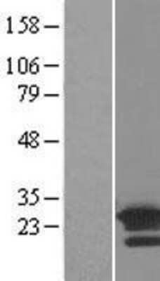 Western Blot: ARL8B Overexpression Lysate (Adult Normal) [NBL1-07704] Left-Empty vector transfected control cell lysate (HEK293 cell lysate); Right -Over-expression Lysate for ARL8B.