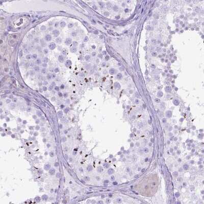 Immunohistochemistry: ARL9 Antibody [NBP2-49679] - Staining of human testis shows cytoplasmic positivity in spermatids.