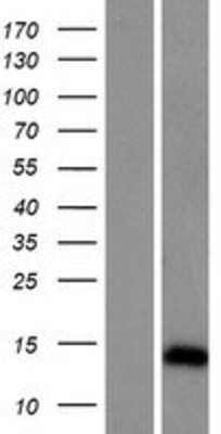 Western Blot: ARL9 Overexpression Lysate (Adult Normal) [NBP2-04520] Left-Empty vector transfected control cell lysate (HEK293 cell lysate); Right -Over-expression Lysate for ARL9.
