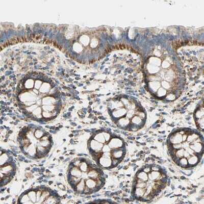 Immunohistochemistry-Paraffin: ARMC10 Antibody [NBP1-81127] - Staining of human colon shows moderate to strong granular cytoplasmic positivity in glandular cells.
