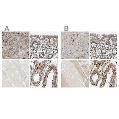 <b>Independent Antibodies Validation. </b>Immunohistochemistry-Paraffin: ARMC10 Antibody [NBP1-81127] - Staining of human cerebral cortex, colon, skeletal muscle and testis using Anti-ARMC10 antibody NBP1-81127 (A) shows similar protein distribution across tissues to independent antibody NBP1-81128 (B).