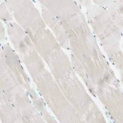 Immunohistochemistry-Paraffin: ARMC10 Antibody [NBP1-81127] - Staining of human skeletal muscle shows very weak positivity in myocytes.