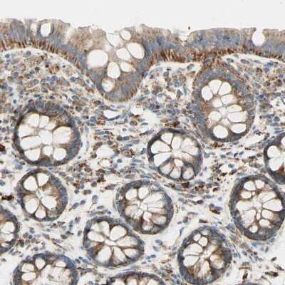 Immunohistochemistry-Paraffin: ARMC10 Antibody [NBP1-81128] - Staining of human colon shows moderate to strong granular cytoplasmic positivity in glandular cells.