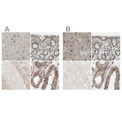 Immunohistochemistry-Paraffin: ARMC10 Antibody [NBP1-81128] - Staining of human cerebral cortex, colon, skeletal muscle and testis using Anti-ARMC10 antibody NBP1-81128 (A) shows similar protein distribution across tissues to independent antibody NBP1-81127 (B).