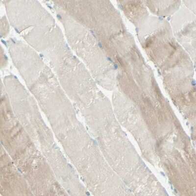 Immunohistochemistry-Paraffin: ARMC10 Antibody [NBP1-81128] - Staining of human skeletal muscle shows very weak positivity in myocytes.