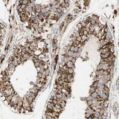 Immunohistochemistry-Paraffin: ARMC10 Antibody [NBP1-81128] - Staining of human testis shows strong granular cytoplasmic positivity in cells in seminiferous ducts.