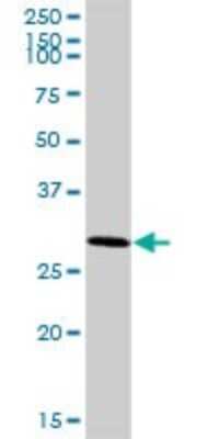 Western Blot: ARMC10 Antibody [H00083787-B01P] - Analysis of SVH expression in human liver.