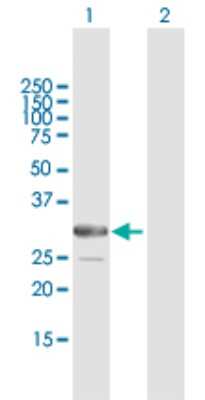 Western Blot: ARMC10 Antibody [H00083787-B01P] - Analysis of ARMC10 expression in transfected 293T cell line by ARMC10 polyclonal antibody.  Lane 1: SVH transfected lysate(33.88 KDa). Lane 2: Non-transfected lysate.