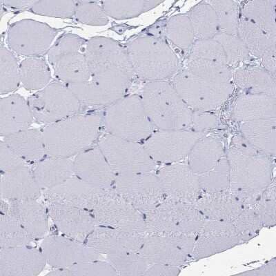 Immunohistochemistry-Paraffin ARMC12 Antibody - BSA Free