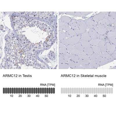 Immunohistochemistry-Paraffin ARMC12 Antibody - BSA Free