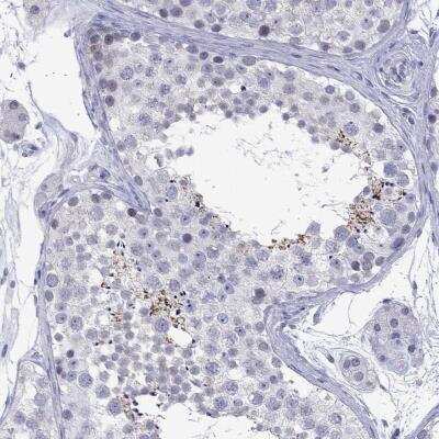 Immunohistochemistry-Paraffin ARMC12 Antibody - BSA Free