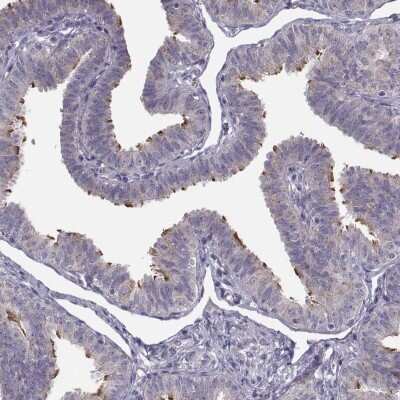 Immunohistochemistry-Paraffin ARMC3 Antibody - BSA Free