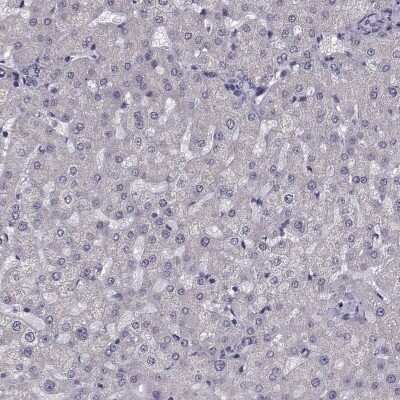 Immunohistochemistry-Paraffin ARMC3 Antibody - BSA Free