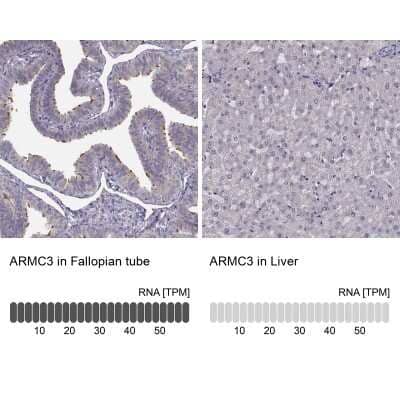 Immunohistochemistry-Paraffin ARMC3 Antibody - BSA Free