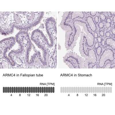 Immunohistochemistry-Paraffin ARMC4 Antibody - BSA Free