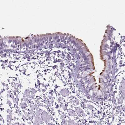 Immunohistochemistry-Paraffin ARMC4 Antibody - BSA Free