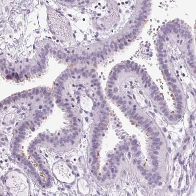 Immunohistochemistry-Paraffin ARMC4 Antibody - BSA Free