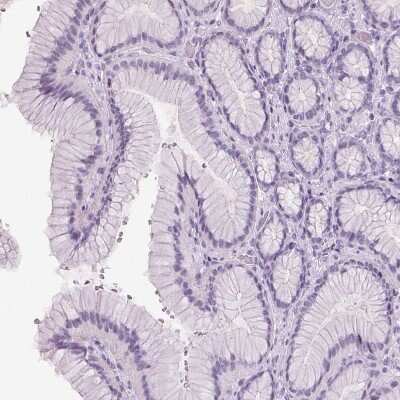 Immunohistochemistry-Paraffin: ARMC4 Antibody [NBP1-84175] - Staining of human stomach shows no positivity in glandular cells as expected.