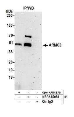 ARMC6 Antibody [NBP2-59088] - Detection of human ARMC6 by western blot of immunoprecipitates. Samples: Whole cell lysate (0.5 or 1.0 mg per IP reaction; 20% of IP loaded) from 293T cells prepared using NETN lysis buffer. Antibodies: Affinity purified rabbit anti-ARMC6 antibody NBP2-59088 used for IP at 8 ul per reaction. ARMC6 was also immunoprecipitated by another rabbit anti-ARMC6 antibody. Detection: Chemiluminescence with an exposure time of 3 minutes.