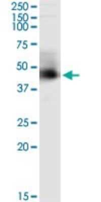 Immunoprecipitation: ARMC8 Antibody (2D9) [H00025852-M01] - Analysis of ARMC8 transfected lysate using anti-ARMC8 monoclonal antibody and Protein A Magnetic Bead, and immunoblotted with ARMC8 monoclonal antibody.