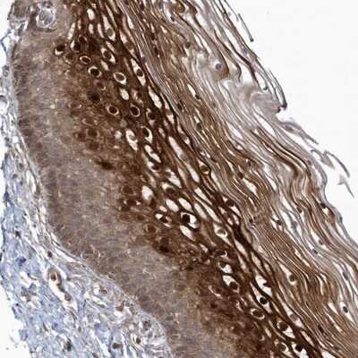 Immunohistochemistry-Paraffin ARMC8 Antibody - BSA Free