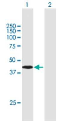 Western Blot: ARMC8 Antibody [H00025852-B01P] - Analysis of ARMC8 expression in transfected 293T cell line by ARMC8 polyclonal antibody.  Lane 1: ARMC8 transfected lysate(42.35 KDa). Lane 2: Non-transfected lysate.