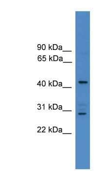 Western Blot: ARMC8 Antibody [NBP1-69203] - 721_B cell lysate, concentration 0.2-1 ug/ml.