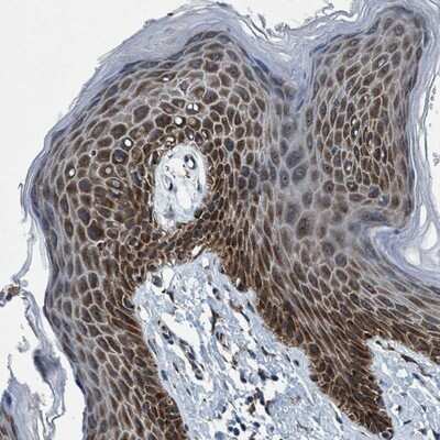 Immunohistochemistry-Paraffin: ARMC9 Antibody [NBP1-88991] - Staining of human vulva/anal skin shows strong cytoplasmic positivity.