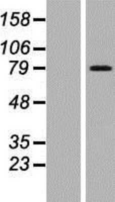 Western Blot: ARMCX2 Overexpression Lysate (Adult Normal) [NBP2-05001] Left-Empty vector transfected control cell lysate (HEK293 cell lysate); Right -Over-expression Lysate for ARMCX2.