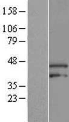 Western Blot: ARMCX3 Overexpression Lysate (Adult Normal) [NBP2-10039] Left-Empty vector transfected control cell lysate (HEK293 cell lysate); Right -Over-expression Lysate for ARMCX3.