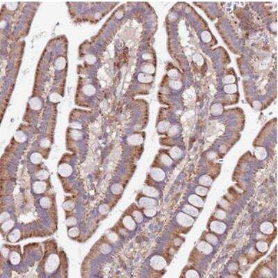Immunohistochemistry: ARMCX6 Antibody [NBP2-30860] - Staining of human small intestine shows strong cytoplasmic positivity in glandular cells.