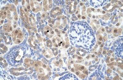 Immunohistochemistry-Paraffin: ARMCX6 Antibody [NBP1-91581] - Human kidney Tissue, antibody concentration 4-8ug/ml. Cells with positive label: renal corpuscle cells (indicated with arrows) 400X magnification.