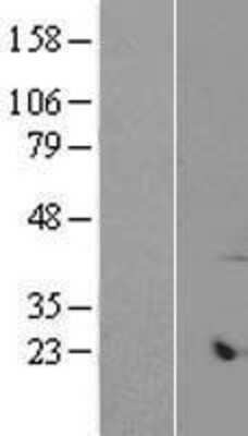 Western Blot: ARMCX6 Overexpression Lysate (Adult Normal) [NBP2-08706] Left-Empty vector transfected control cell lysate (HEK293 cell lysate); Right -Over-expression Lysate for ARMCX6.
