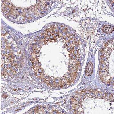 Immunohistochemistry-Paraffin: ARMER Antibody [NBP1-91681] - Staining of human testis shows weak to moderate cytoplasmic positivity in cells in seminiferous ducts.