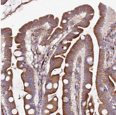 Immunohistochemistry-Paraffin: ARMER Antibody [NBP1-91681] - Staining of human small intestine shows moderate to strong cytoplasmic positivity in glandular cells.