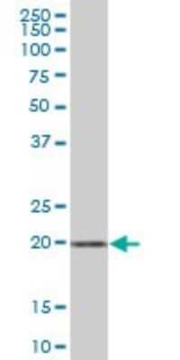 Western Blot: ARMER Antibody [H00023204-B02P] - Analysis of ARL6IP expression in human liver.