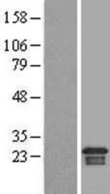 Western Blot: ARMER Overexpression Lysate (Adult Normal) [NBL1-07700] Left-Empty vector transfected control cell lysate (HEK293 cell lysate); Right -Over-expression Lysate for ARMER.