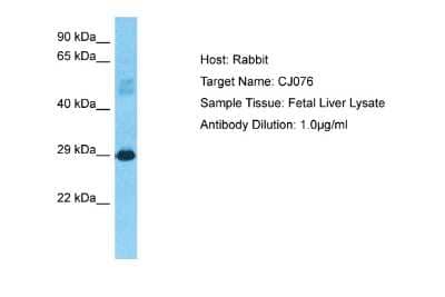 Western Blot: ARMH3 Antibody [NBP2-84467] - Host: Rabbit. Target Name: CJ076. Sample Type: Fetal Liver lysates. Antibody Dilution: 1.0ug/ml