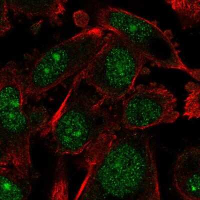 Immunocytochemistry/Immunofluorescence: ARNTL2 Antibody [NBP2-32423] - Staining of human cell line PC-3 shows localization to nucleus & nucleoli. Antibody staining is shown in green.