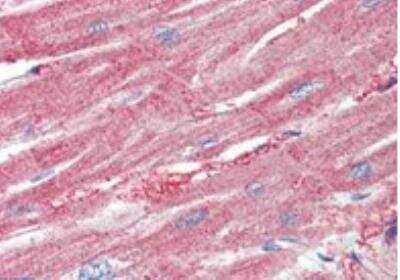 Immunohistochemistry-Paraffin ARPC1A Antibody