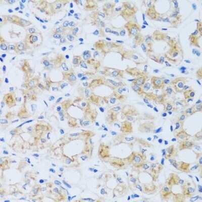 Immunohistochemistry-Paraffin: ARPC1A Antibody [NBP3-04783] - Paraffin-embedded human stomach using ARPC1A antibody at dilution of 1:100 (40x lens).