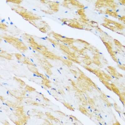Immunohistochemistry-Paraffin: ARPC1A Antibody [NBP3-04783] - Paraffin-embedded mouse heart using ARPC1A antibody at dilution of 1:100 (40x lens).
