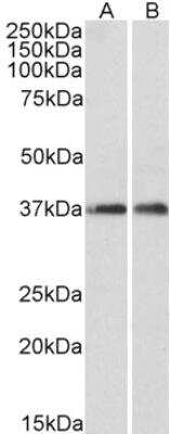 Western Blot ARPC1A Antibody